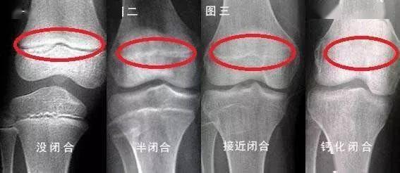 成人怎样长高视频教程,跟随视频教程轻松实现理想身高